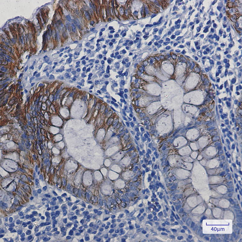 Cytokeratin 19 Rabbit mAb ABZ2916