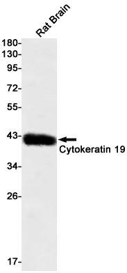 Cytokeratin 19 Rabbit mAb ABZ2916
