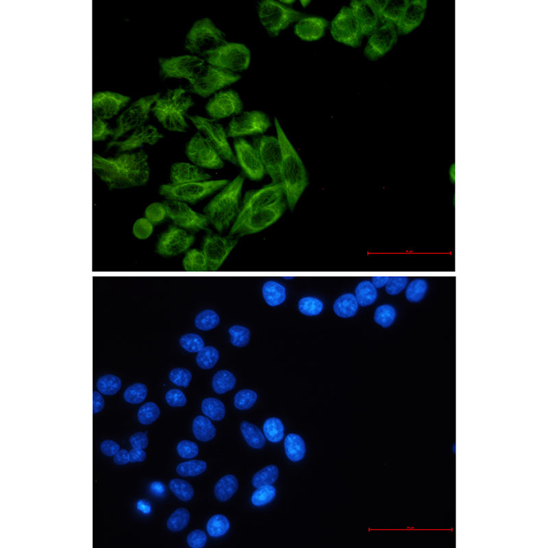 Cytokeratin 7 Rabbit mAb ABZ2917