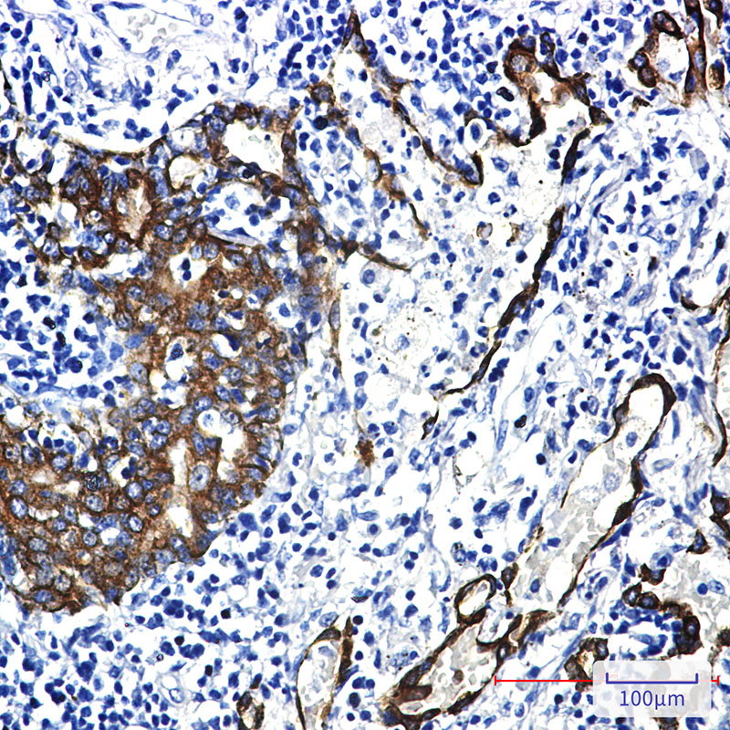 Cytokeratin 7 Rabbit mAb ABZ2917