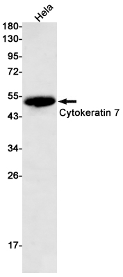 Cytokeratin 7 Rabbit mAb ABZ2917