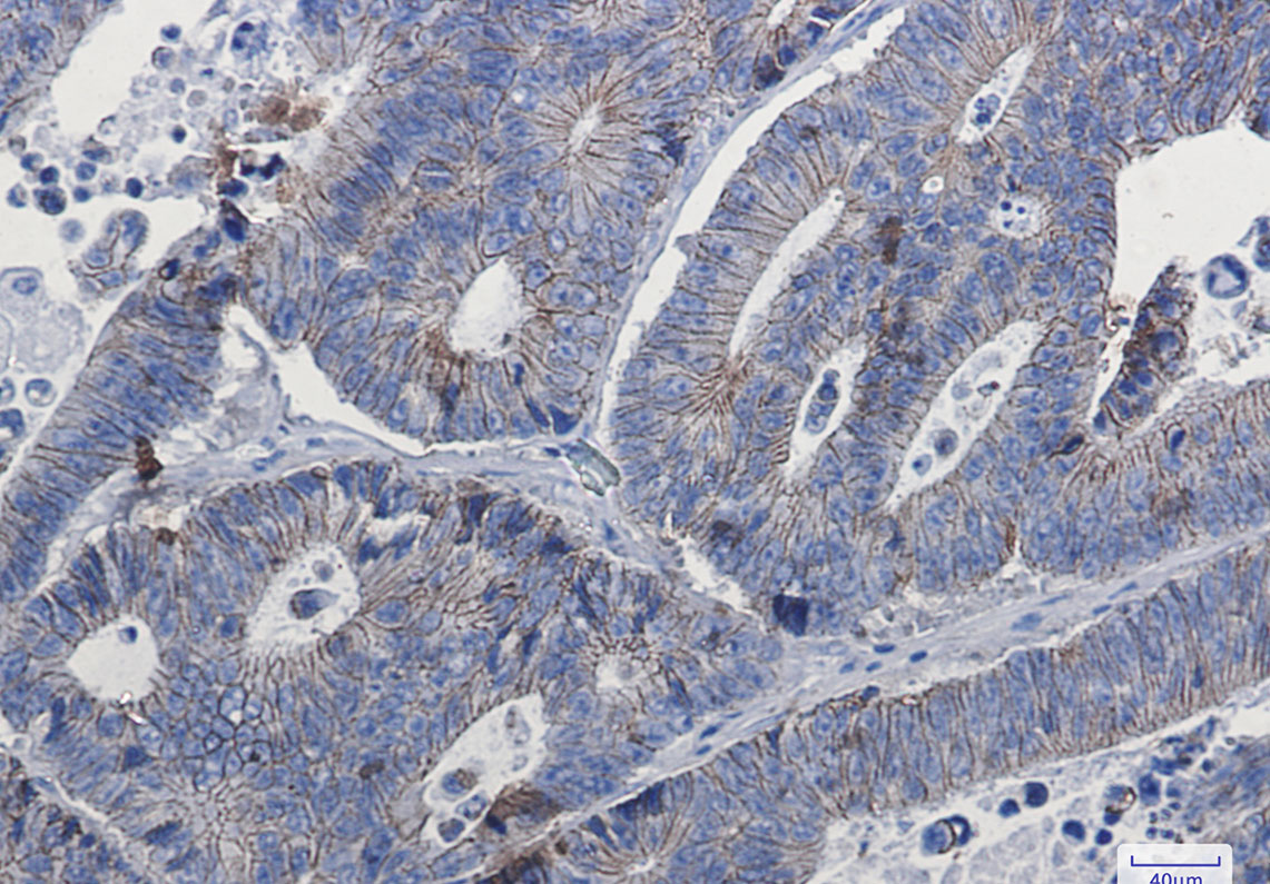 delta 1 Catenin Rabbit mAb ABZ2920