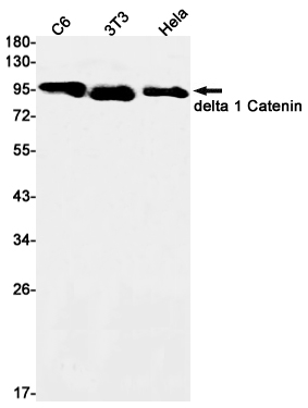 delta 1 Catenin Rabbit mAb ABZ2920