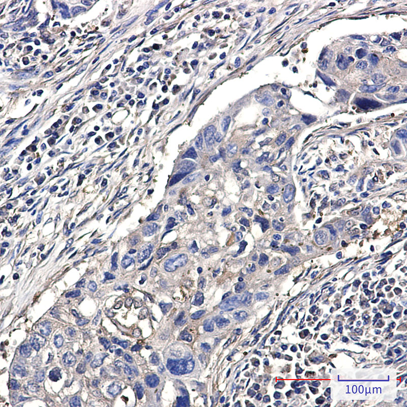 DSTN Rabbit mAb ABZ2921