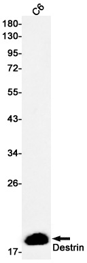 DSTN Rabbit mAb ABZ2921