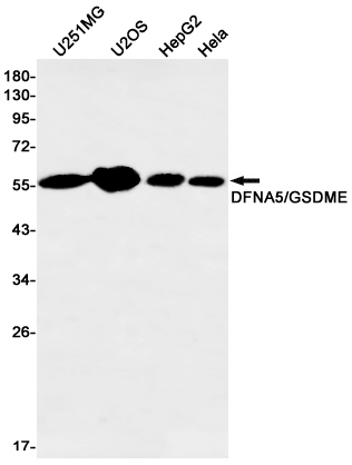 DFNA5/GSDME Rabbit mAb ABZ2922