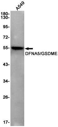 DFNA5/GSDME Rabbit mAb ABZ2923