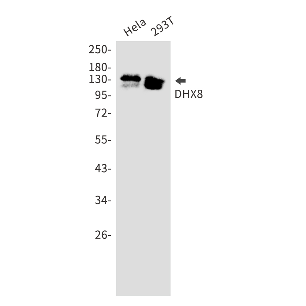 DHX8 Rabbit mAb ABZ2925