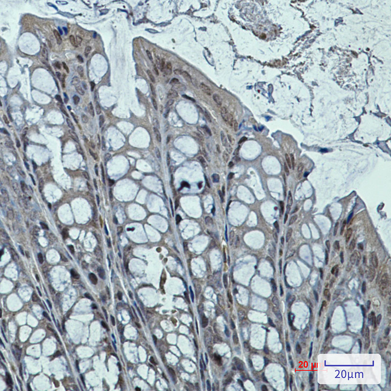 DNAJB6 Rabbit mAb ABZ2928