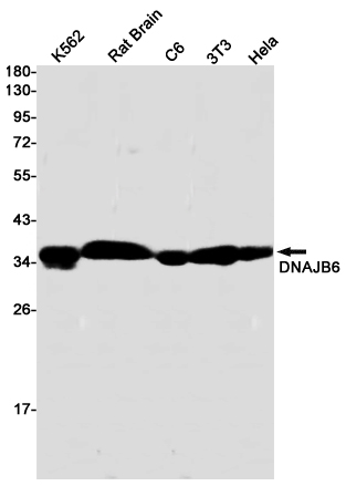 DNAJB6 Rabbit mAb ABZ2928