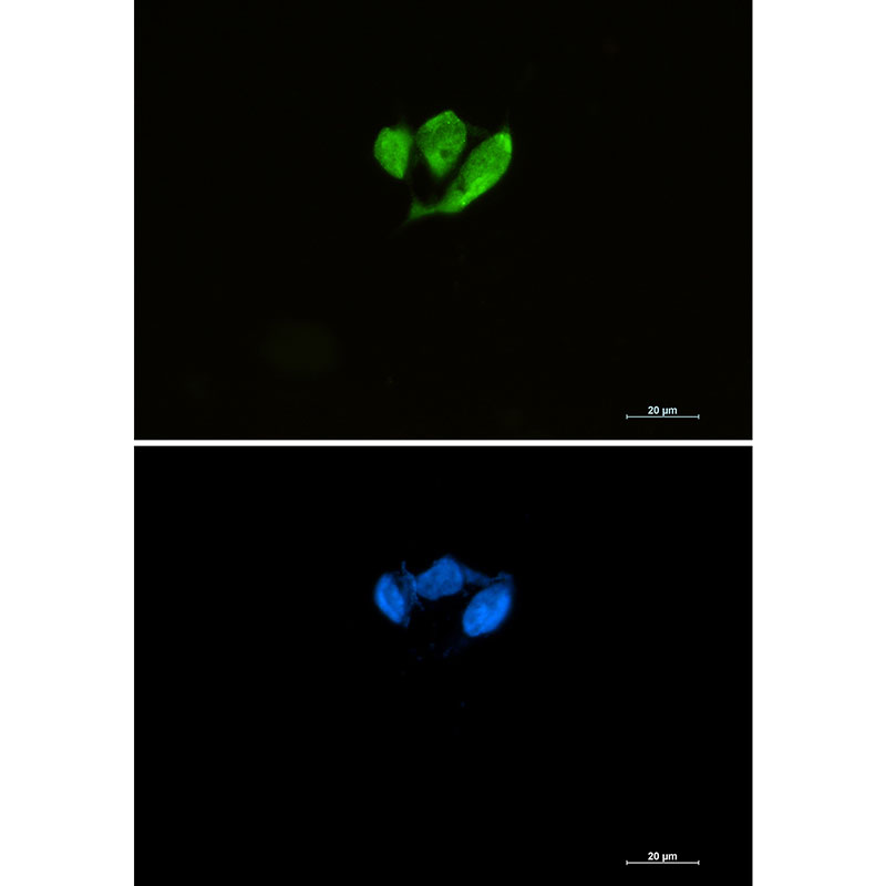 eIF4E Rabbit mAb ABZ2932
