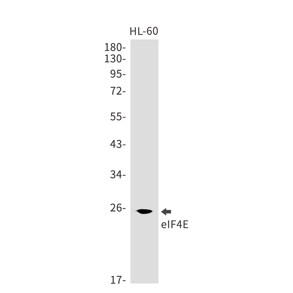 eIF4E Rabbit mAb ABZ2932