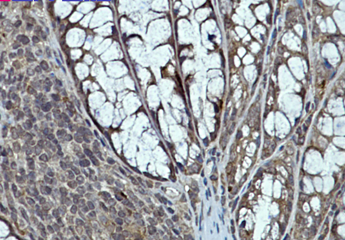 eIF4E Rabbit mAb ABZ2933