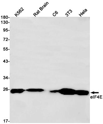 eIF4E Rabbit mAb ABZ2933