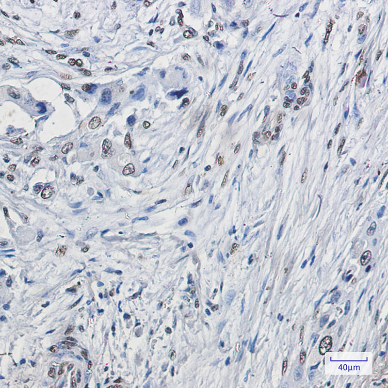 ELK1 Rabbit mAb ABZ2934
