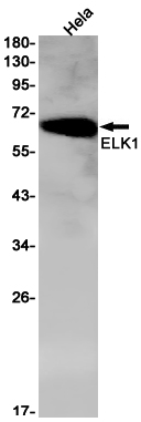 ELK1 Rabbit mAb ABZ2934