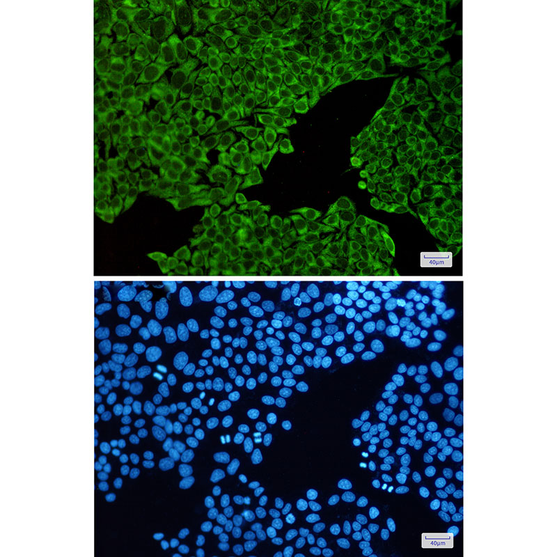 ENO3 Rabbit mAb ABZ2937