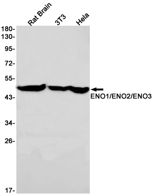 ENO1/2/3 Rabbit mAb ABZ2938
