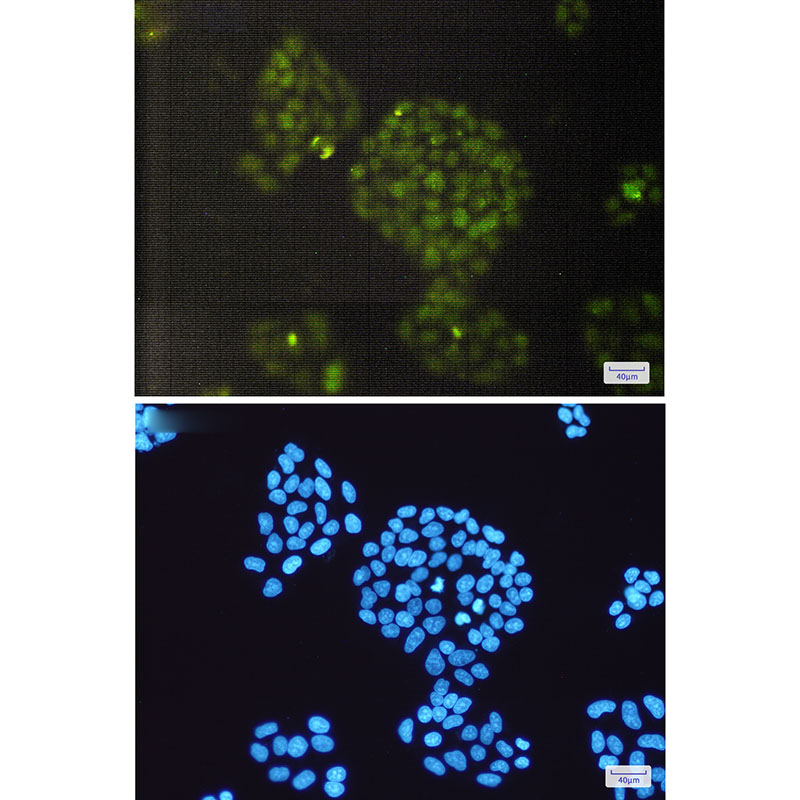 ERCC1 Rabbit mAb ABZ2941