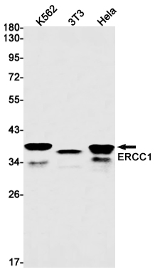 ERCC1 Rabbit mAb ABZ2941
