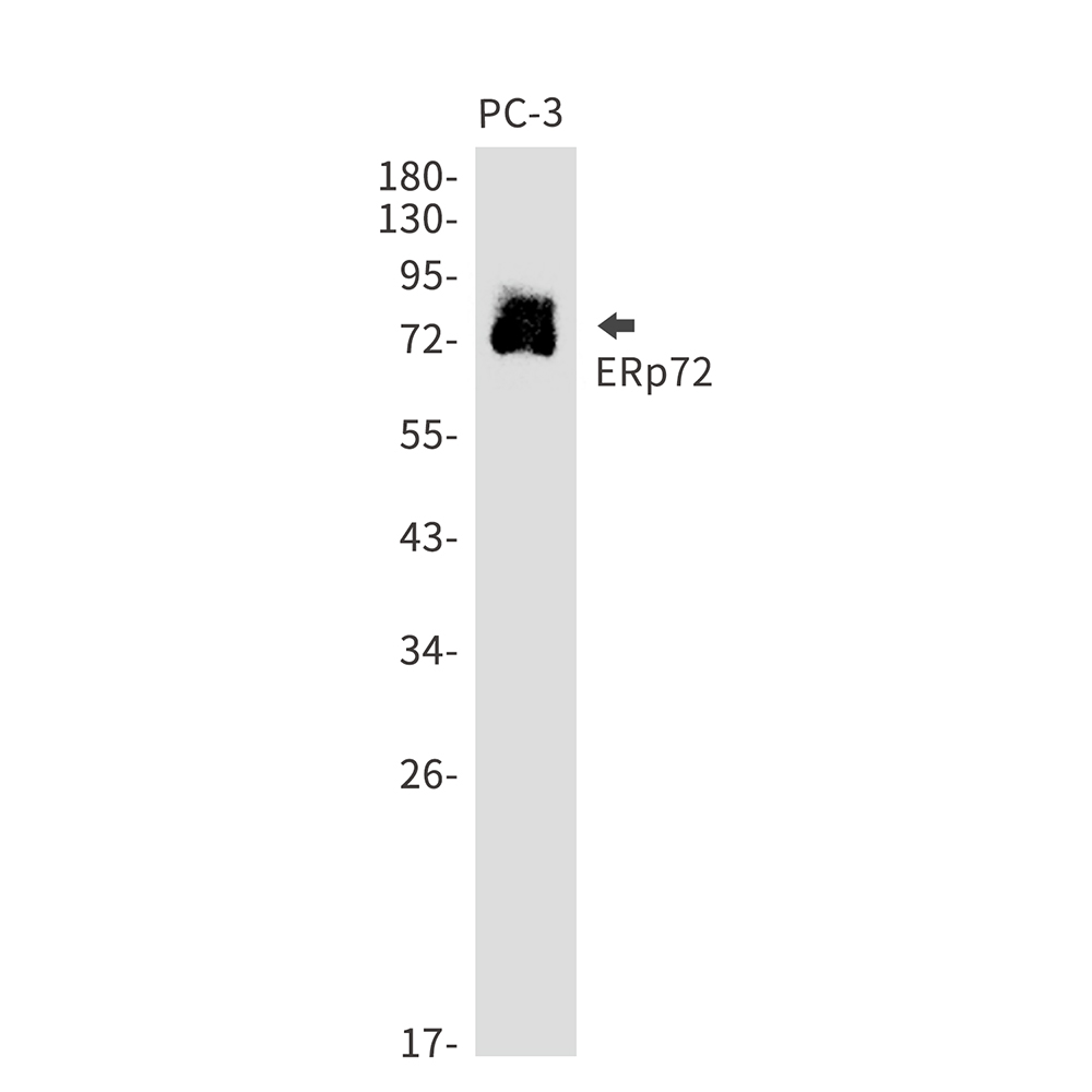 ERp72 Rabbit mAb ABZ2942