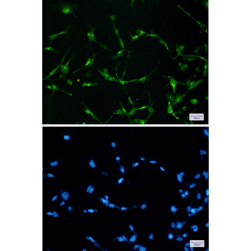 EWSR1 Rabbit mAb ABZ2943