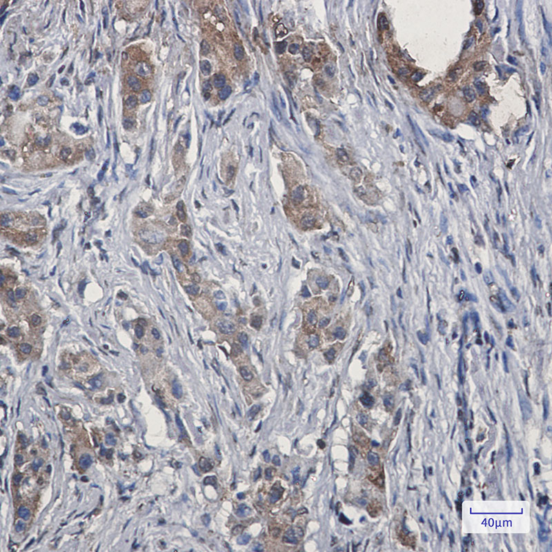 Ezrin Rabbit mAb ABZ2944