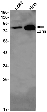 Ezrin Rabbit mAb ABZ2944
