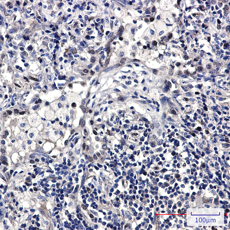 FDPS/FPS Rabbit mAb ABZ2947