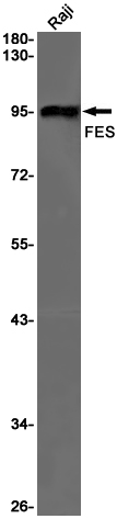 FES Rabbit mAb ABZ2948