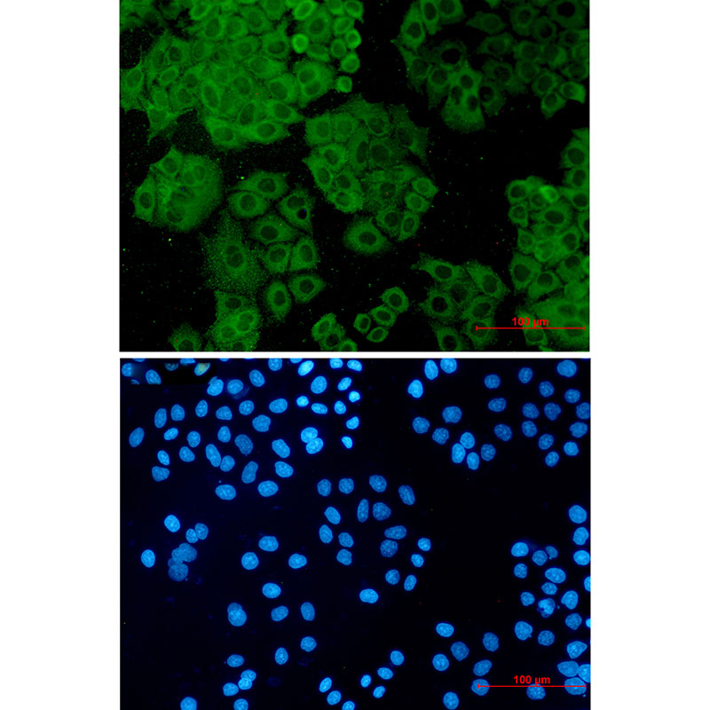 FH/Fumarase Rabbit mAb ABZ2951