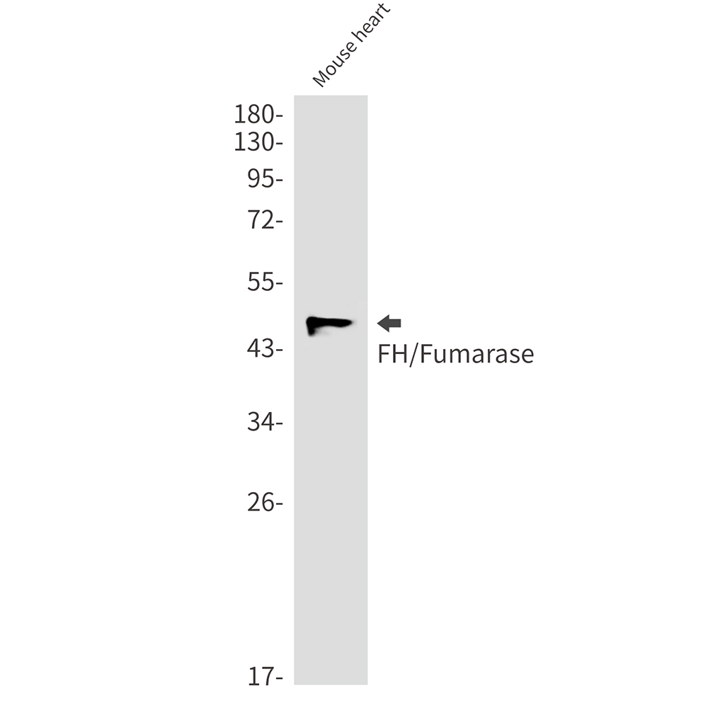 FH/Fumarase Rabbit mAb ABZ2951