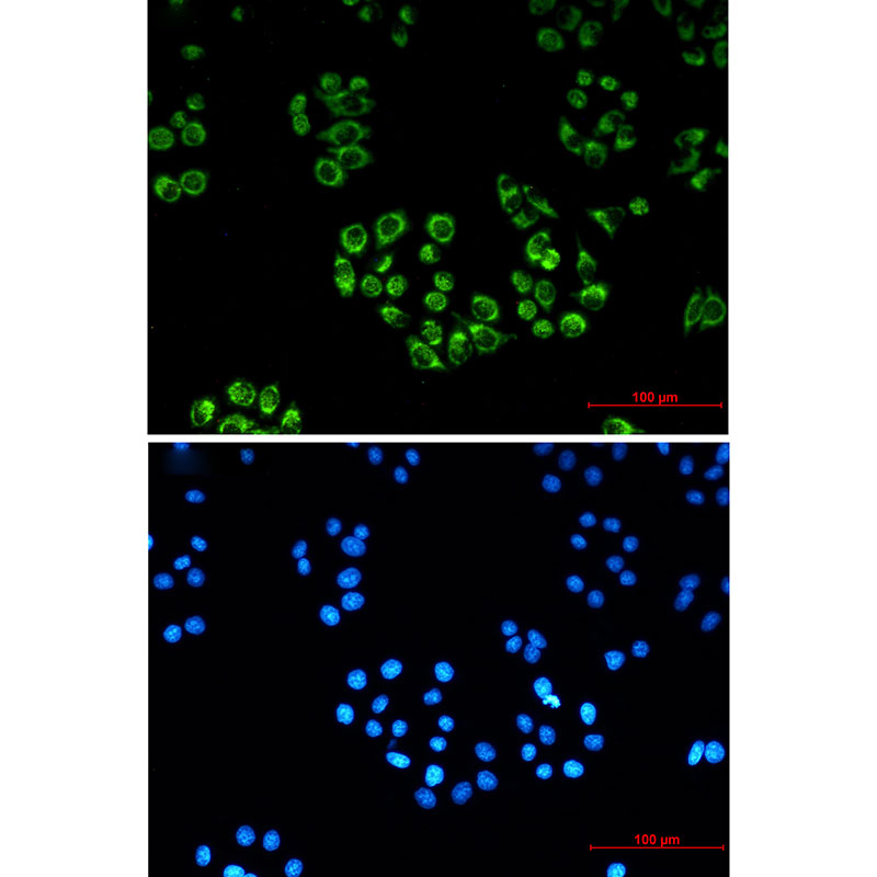 FH/Fumarase Rabbit mAb ABZ2952