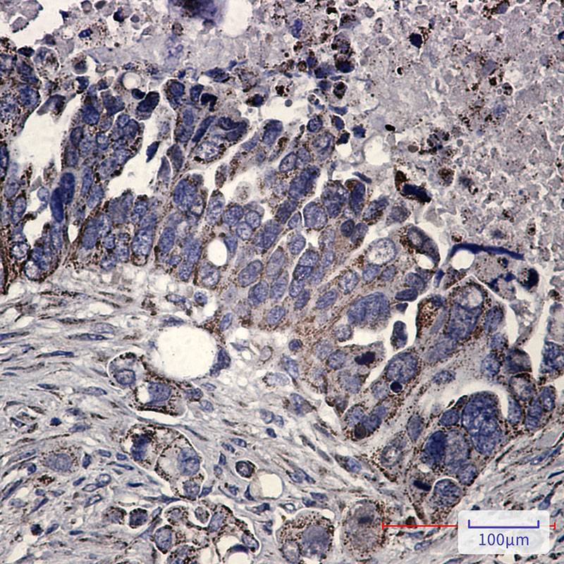 FH/Fumarase Rabbit mAb ABZ2952