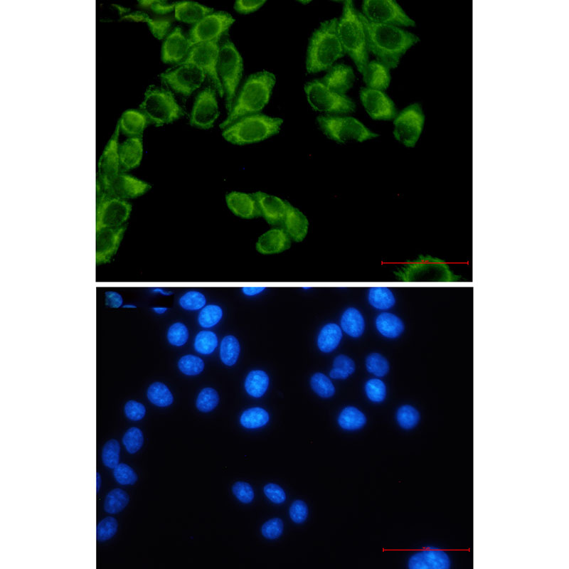 FH/Fumarase Rabbit mAb ABZ2953