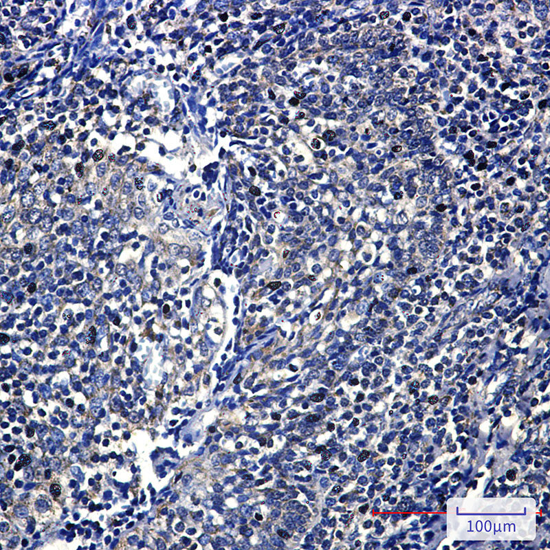 FH/Fumarase Rabbit mAb ABZ2953