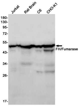 FH/Fumarase Rabbit mAb ABZ2953