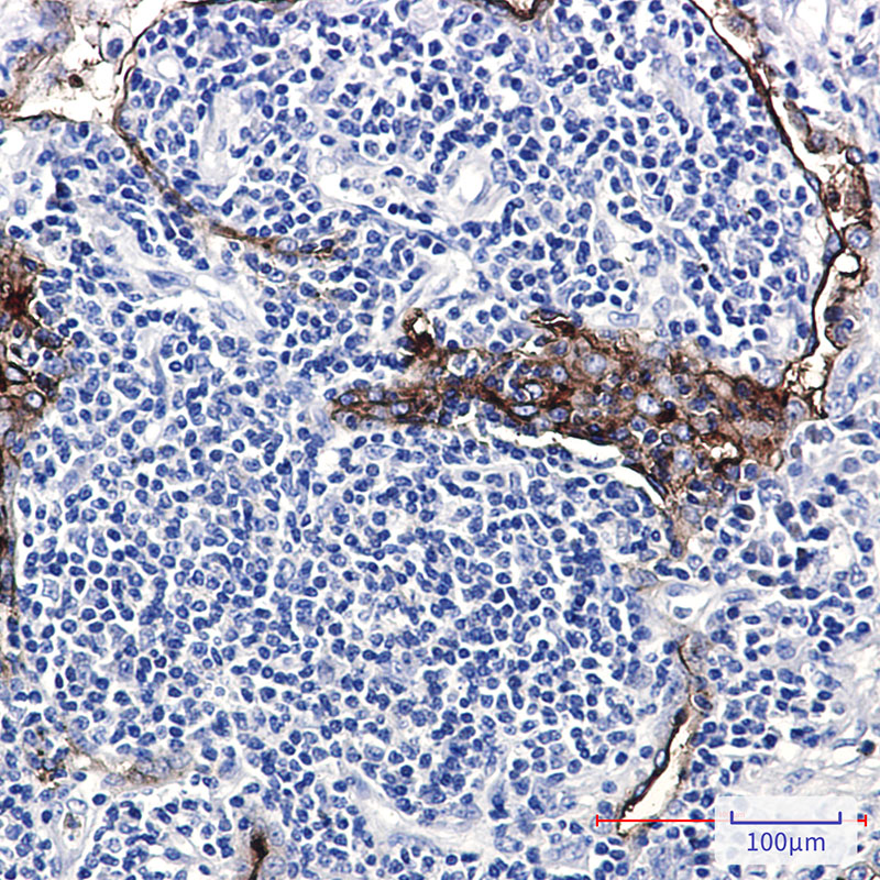 Folate Binding Protein/FBP Rabbit mAb ABZ2957