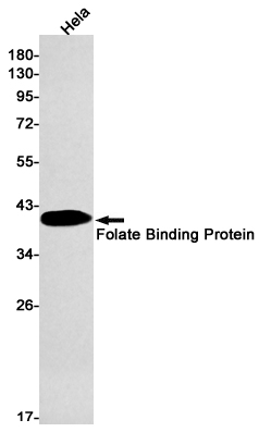 Folate Binding Protein/FBP Rabbit mAb ABZ2957
