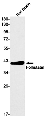 Follistatin Rabbit mAb ABZ2958