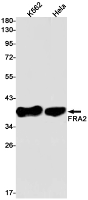 FRA2 Rabbit mAb ABZ2959