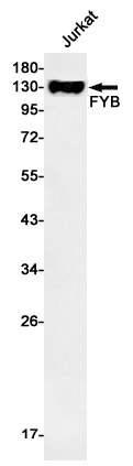 FYB Rabbit mAb ABZ2960