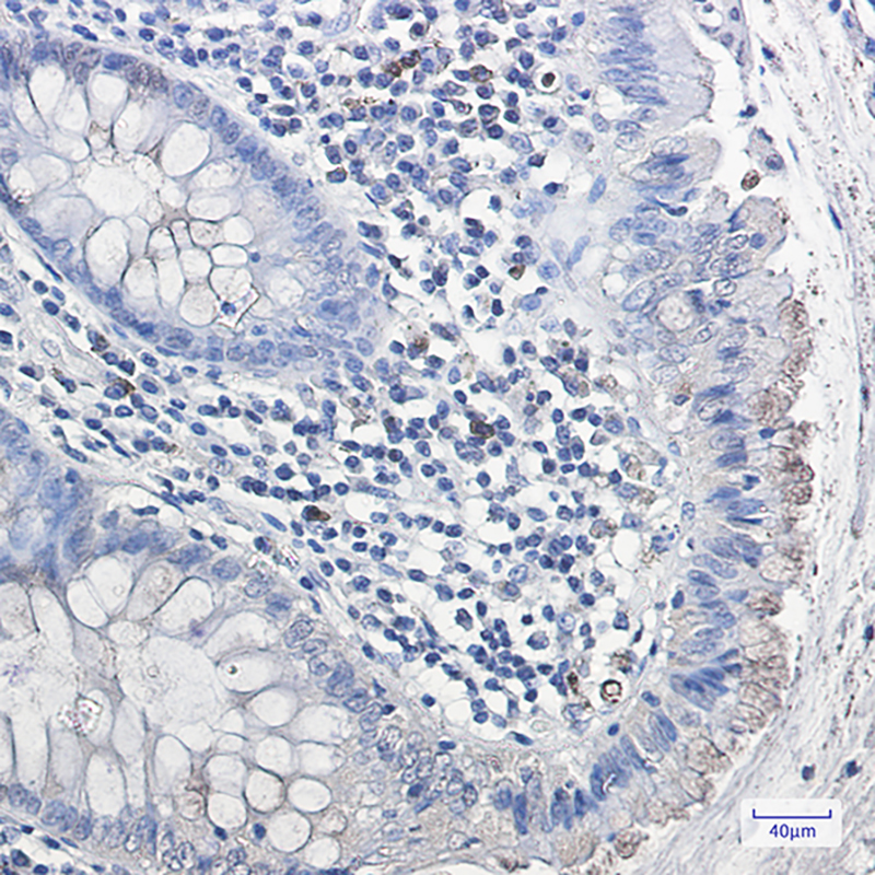 Galactosidase alpha Rabbit mAb ABZ2962