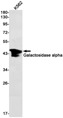 Galactosidase alpha Rabbit mAb ABZ2962