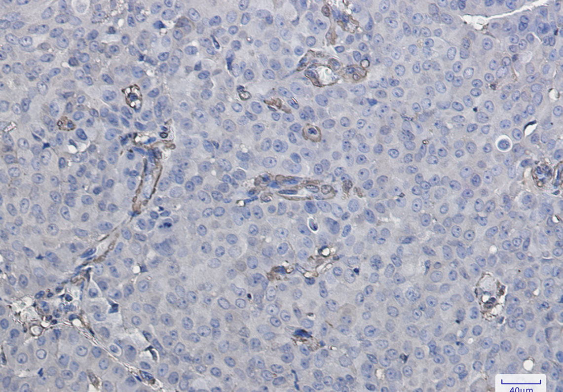 Galectin 1 Rabbit mAb ABZ2963