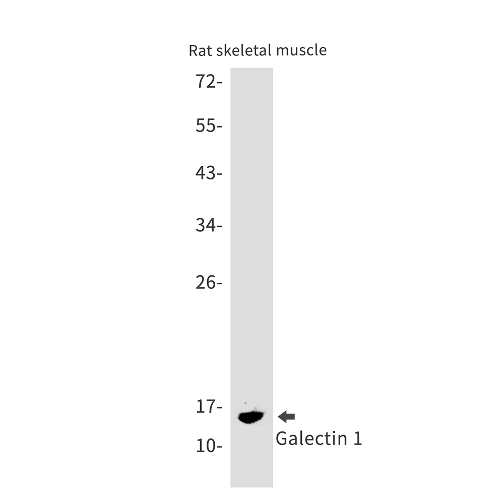 Galectin 1 Rabbit mAb ABZ2963