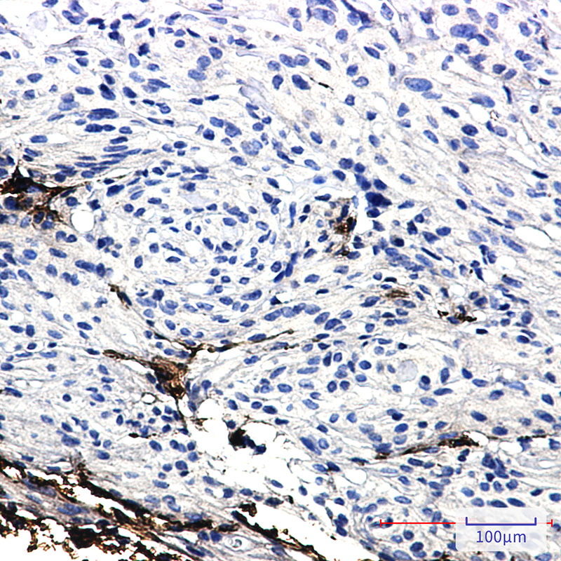 GFAP Rabbit mAb ABZ2966