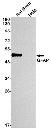 GFAP Rabbit mAb ABZ2966