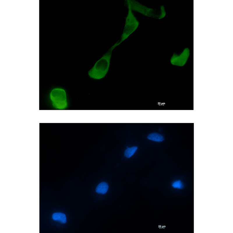 GFPT2 Rabbit mAb ABZ2967
