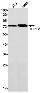 GFPT2 Rabbit mAb ABZ2967
